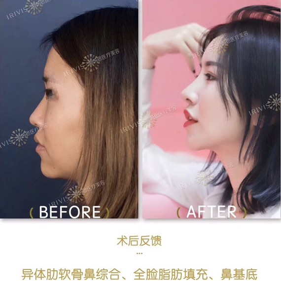 这样的侧脸,你要不要?