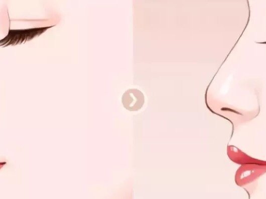 【科普】肋软骨隆鼻,你想知道的都在这