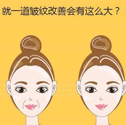 ♀小仙女出现法令纹之后|如何解决呢