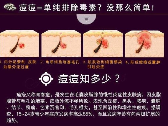 青春期如何祛痘