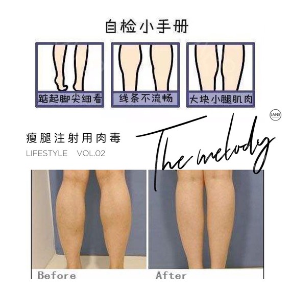打了医院针后腿越来越粗了!Why?车瘦腿告诉大郑州美莱医疗美容瘦脸医生针v医院图片