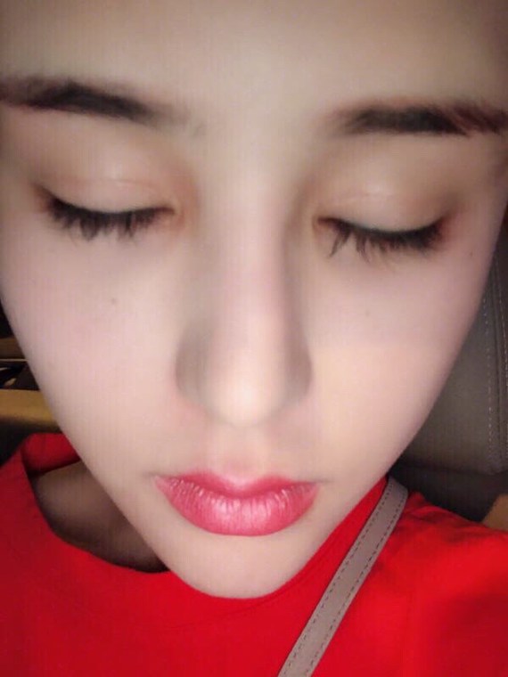 你割双眼皮前,需要先知道这些看过来!你们关心