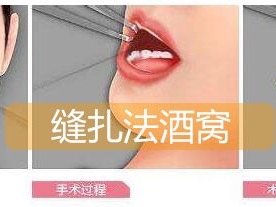 妖精♀炼成术多个酒窝就成天使脸!!梨涡浅笑迷死人~都说有酒窝_圈子-新氧美容整形