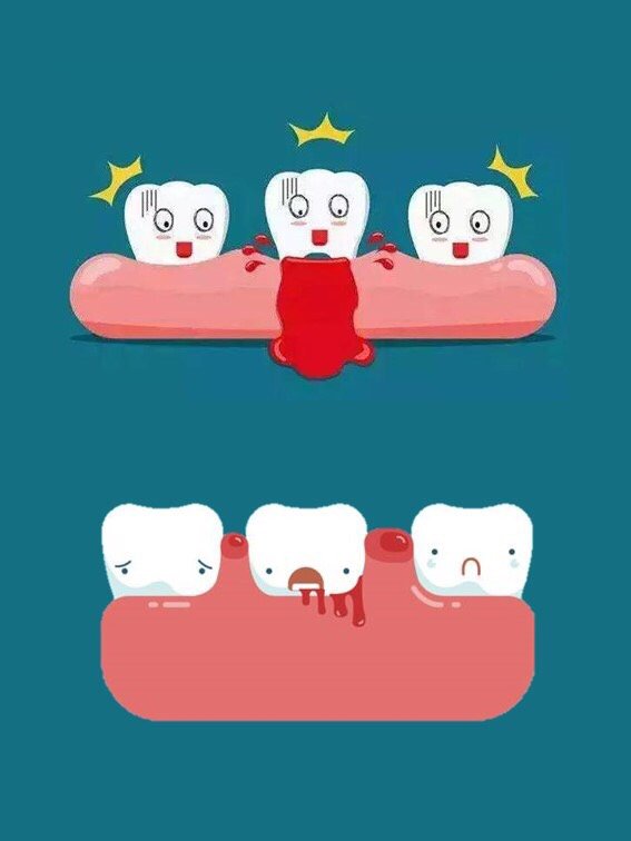 牙龈出血会导致牙齿脱落千万不可忽视