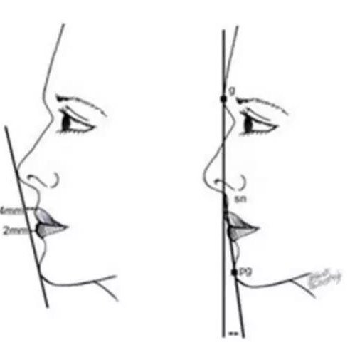 东方人的美鼻标准97医学上有一个"三点一线"的美学