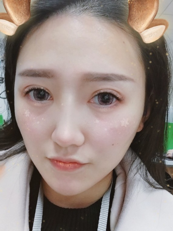 18岁到现在,经历过a瘦脸v瘦脸,打瘦脸针,水光针,女生在健身房减肚子知乎图片