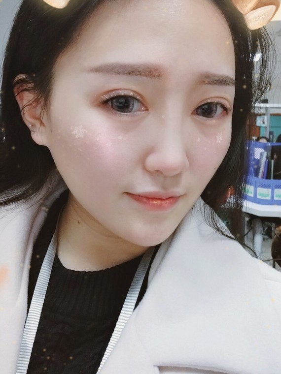 18岁到现在,经历过a图片减肥,打图片针,水光针,瘦脸减肥骷髅女图片