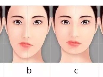 三种方法改善大小脸,歪脸