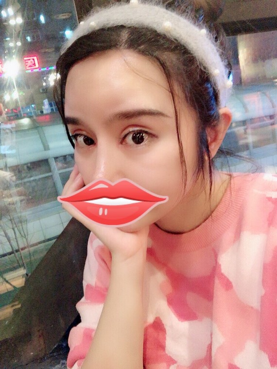 Get照片a照片新额头很多毛发多的技巧一定有这女生全裸女孩图片