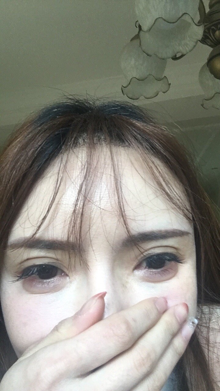 这个对我眼睛下面细纹鸡爪纹有用吗
