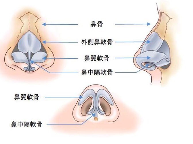 什么是鼻骨内推