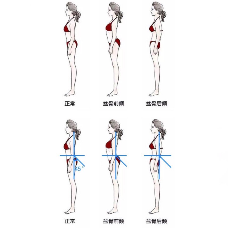 尾脊柱突出而形成翘臀,女性腰椎曲率(lc)成45度角时,对于普通男人的