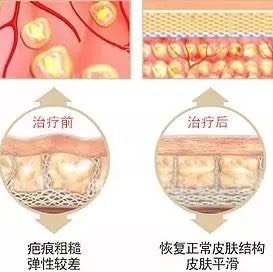 痕?人生何处无创伤?小到蚊虫叮咬、打耳洞;大