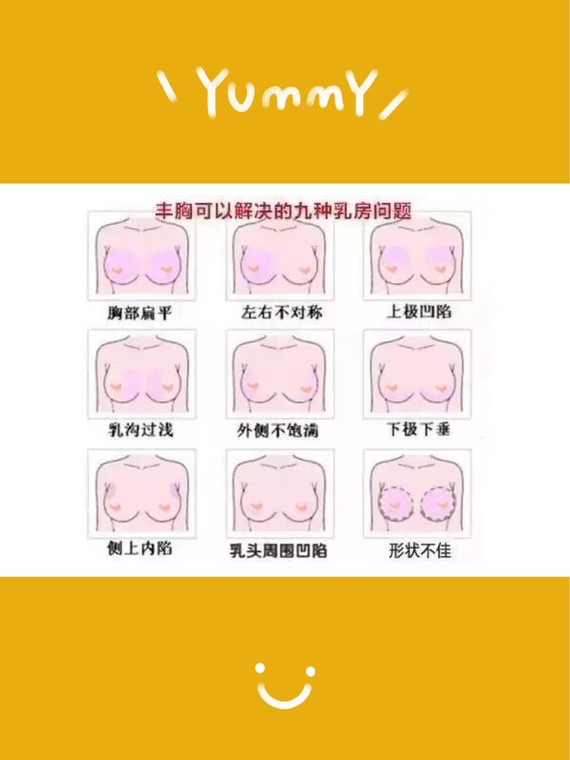 才20多岁,胸就下垂外扩了,该怎么办呢71乳房,作为