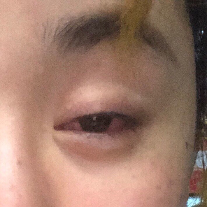 最近眼睛98一直_圈子-新氧