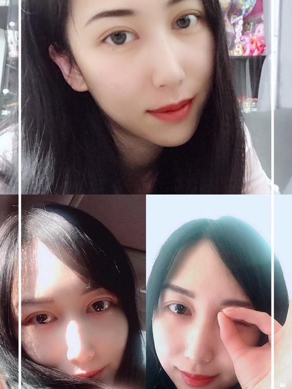 双眼皮越宽越好看么?