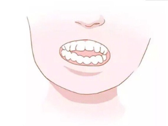 龅牙(牙齿前突)