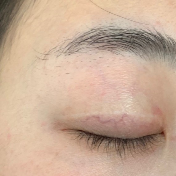 沈阳名流整形医院,这家医院营销做的很好,但是