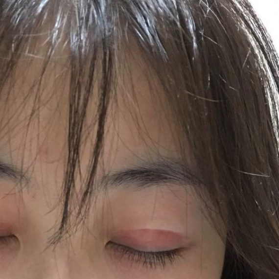 沈阳名流整形医院,这家医院营销做的很好,但是