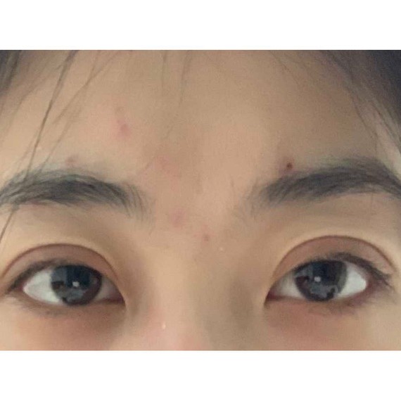 沈阳名流整形医院,这家医院营销做的很好,但是