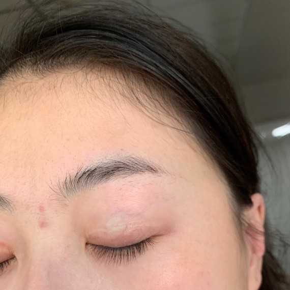 沈阳名流整形医院,这家医院营销做的很好,但是