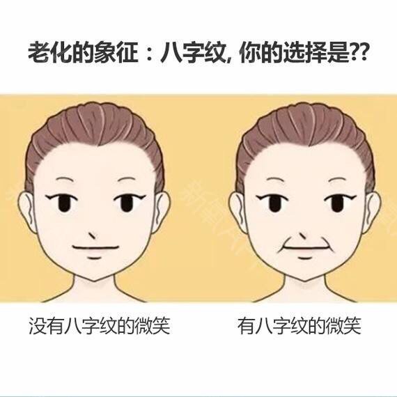 关于脂肪填充法令纹的误区,你是不是也这么认为