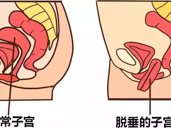 产后这些信号,说明你的盆底肌在