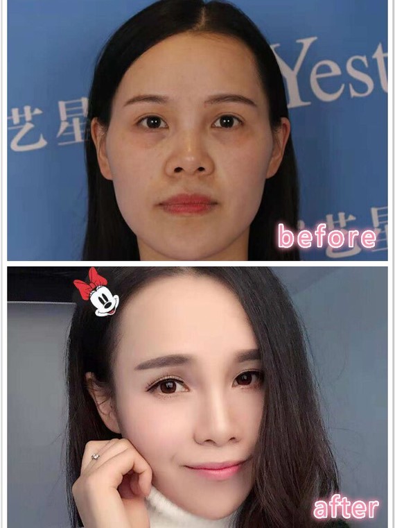 泪沟卧蚕眼袋都分不清,算什么"精致的猪猪女孩"