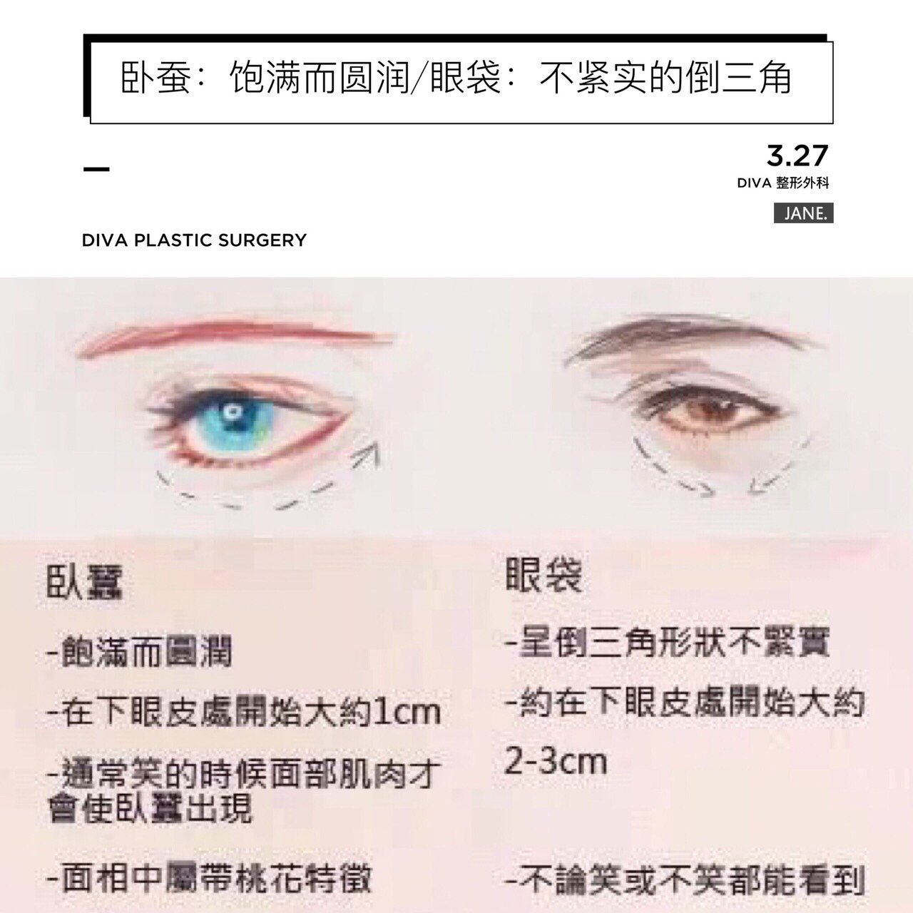 史上最可怕"同居":卧蚕,眼袋,泪沟. 你中了几招?