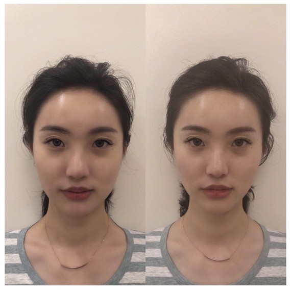 96你不是脸大,你是咬肌大751596生命不息v脸