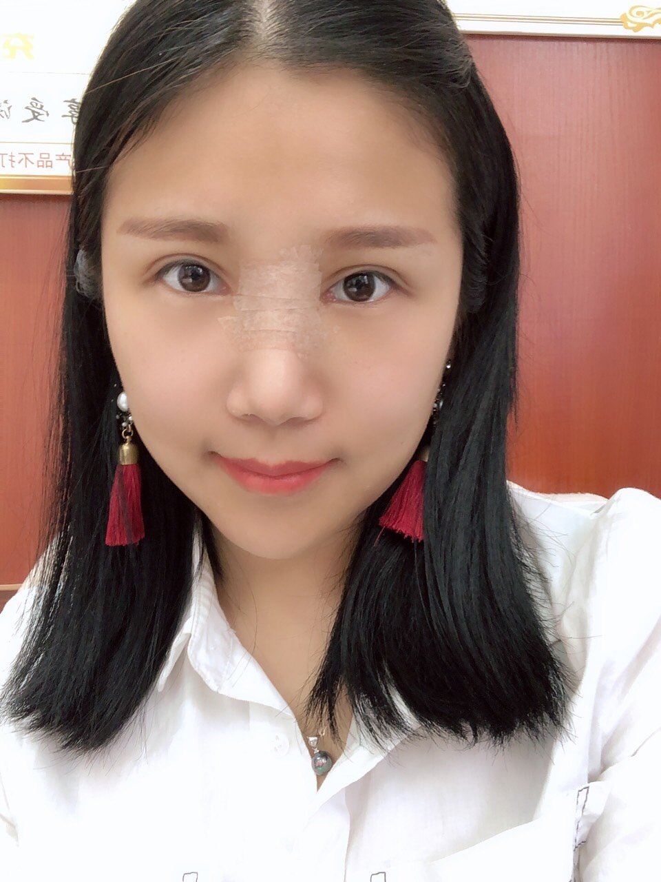 今天第十天,鼻子贴胶布因为要固定一下