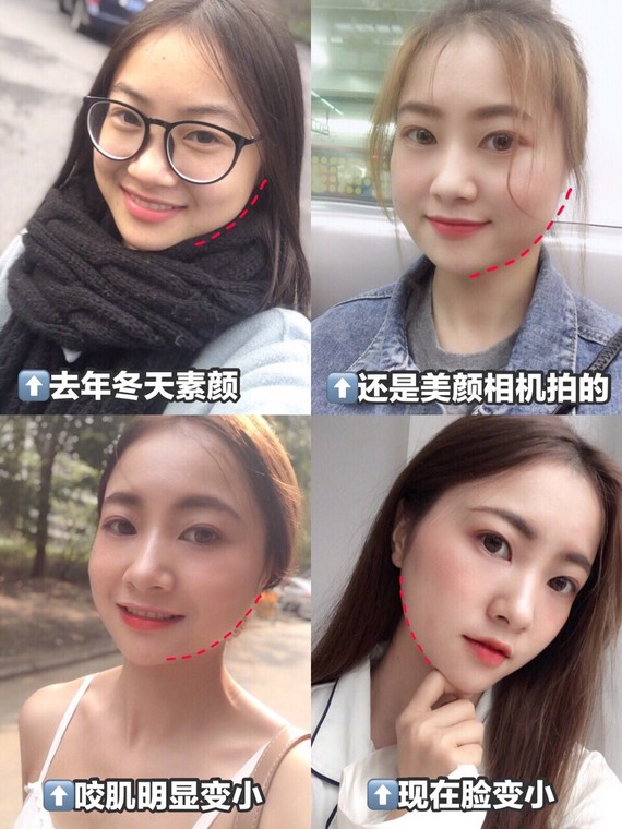 7天见效的魔性下巴法/瘦咬肌、去双蒸汽、消浮瘦脸蒸脸可以瘦脸吗图片