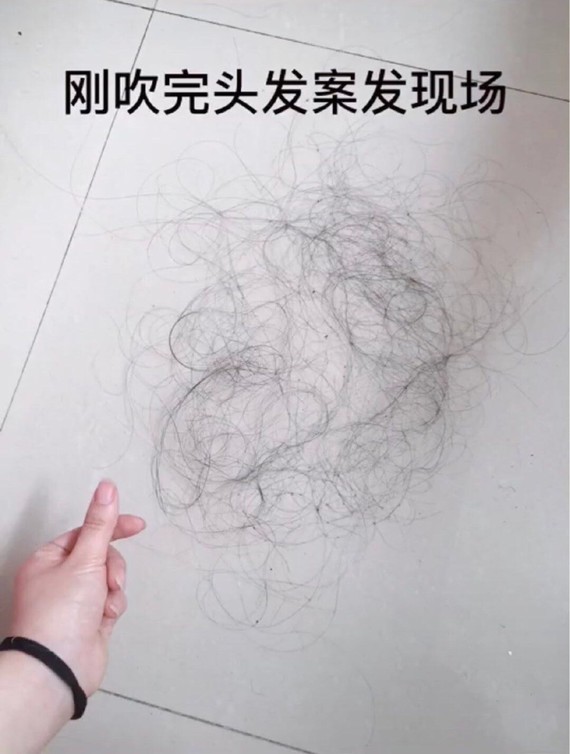 一个月的发量#你敢整理你掉的头发吗?