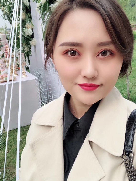 双眼皮手术的历程 面诊的时候是很苦恼的,她本来的眼皮就很厚,眼睛看