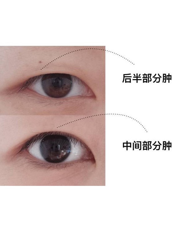 9090天生"内双肿眼泡"很丑?只不过是你不会化妆罢