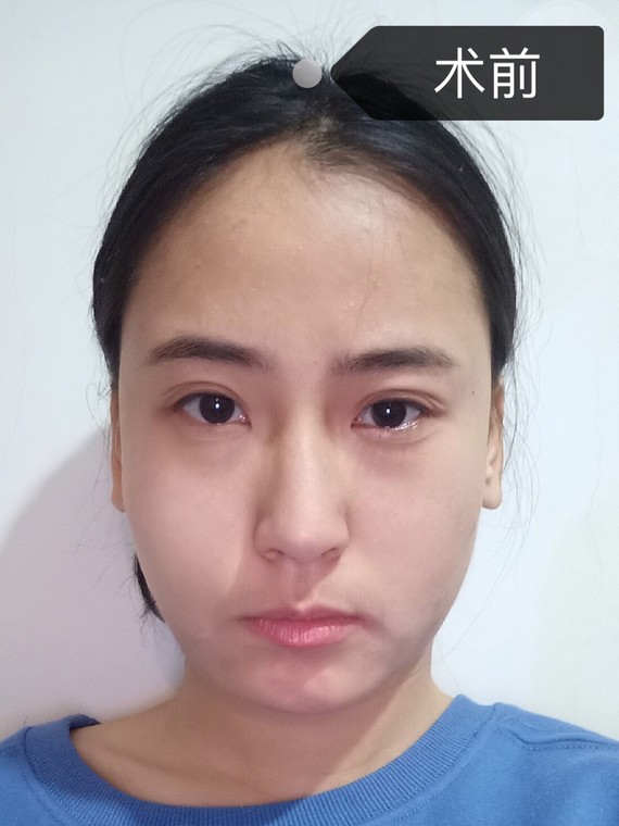 肉干货毒素分享|动作针打凹陷避免6015♀腰上肚子好胖那个瘦脸瑜伽能瘦图片