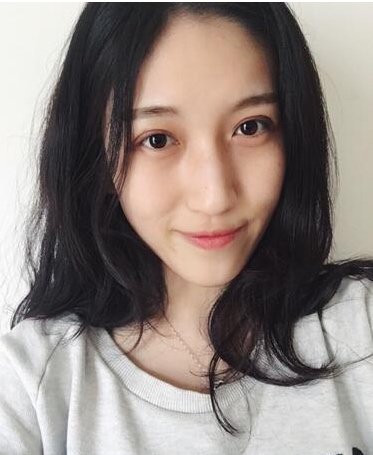 我2年前做过一次双眼皮,但是现在觉得左右眼两边不是很对称,想问下