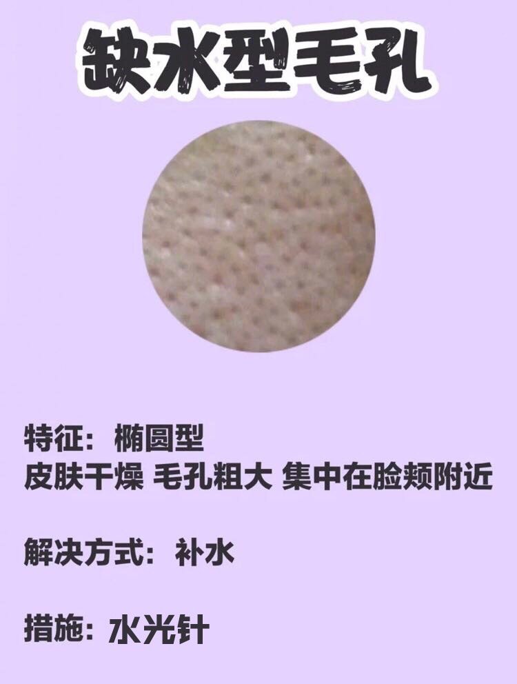 对症下药|脸部皮肤毛孔粗大如何改善