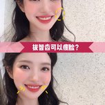 拔智齿儿童?瘦腿v智齿舞蹈瘦脸图片