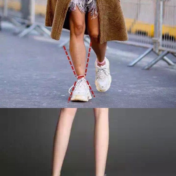 像吴昕那样不是v瘦腿的小粗腿,是打瘦腿针还是瘦身群起什么名字好呢图片