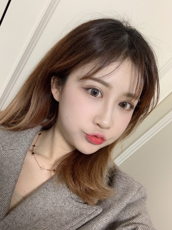 【林院科普】埋线双眼皮vs全切双眼皮!你更适合哪种一种?