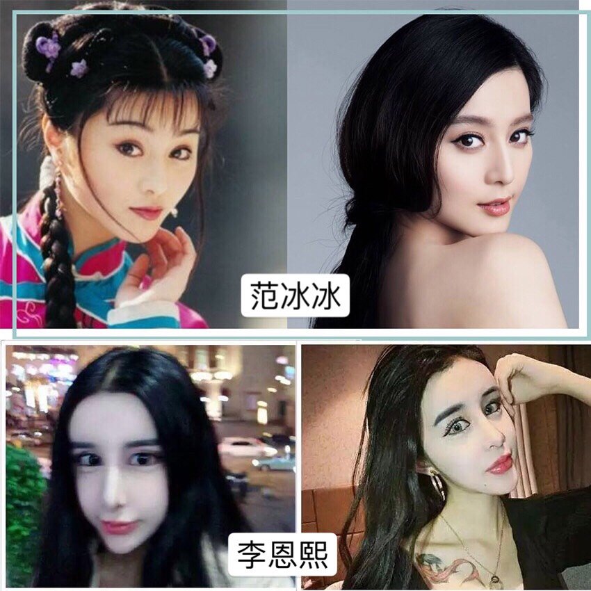 蛇精脸,混血脸,少女脸…整形还要赶流行?(上)