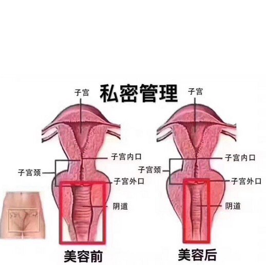 3个动作抗击私密松弛衰老♀♀有遗漏!