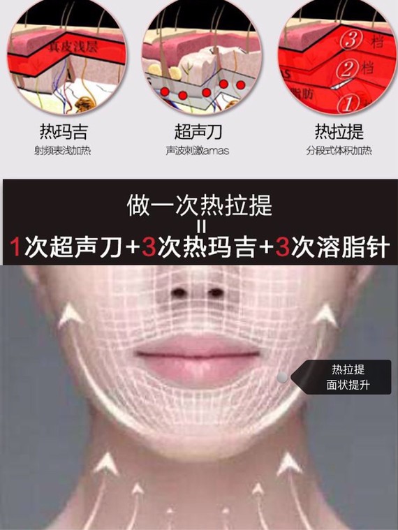 热玛吉or热拉提哪个效果更好?