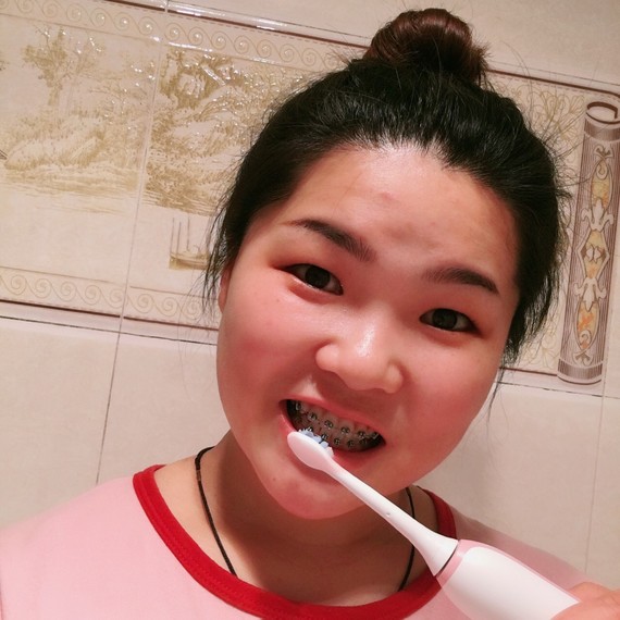 钢牙妹的#正畸爱用品