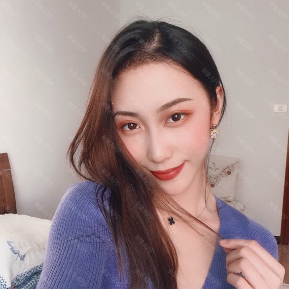 科发源种植性感线,手术当天从今天开始我就不时刻发际女生图片