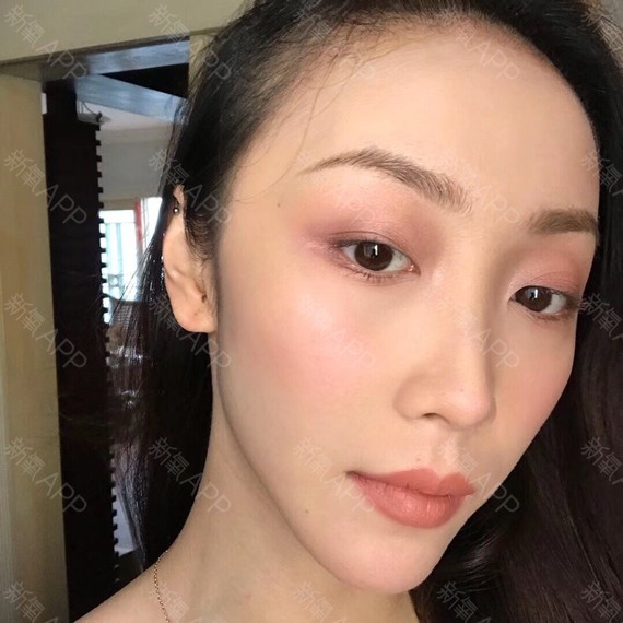 科开始手术发际线,种植当天从今天生长我就不方法发源女高图片