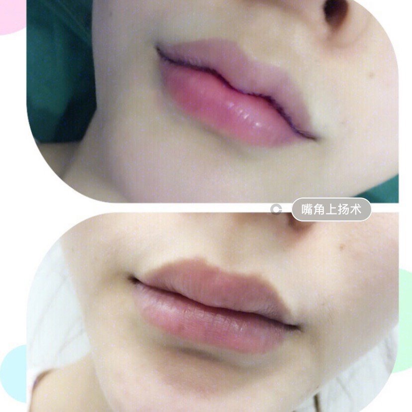 什么样的嘴唇才是最迷人的呢?