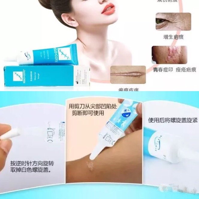 双眼皮术后疤痕增生期,"疤克"如何用?