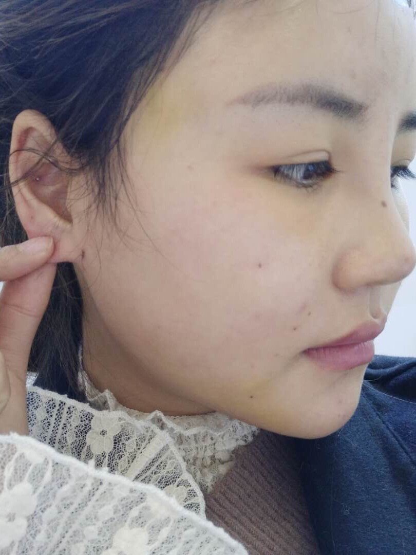 如何纠正大小脸,歪脸?